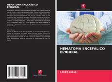 Buchcover von HEMATOMA ENCEFÁLICO EPIDURAL