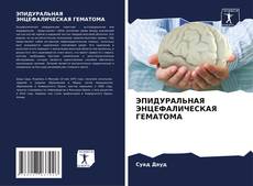 Bookcover of ЭПИДУРАЛЬНАЯ ЭНЦЕФАЛИЧЕСКАЯ ГЕМАТОМА