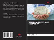 Buchcover von EPIDURAL ENCEPHALIC HEMATOMA
