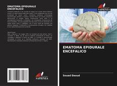 Bookcover of EMATOMA EPIDURALE ENCEFALICO