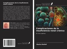Bookcover of Complicaciones de la insuficiencia renal crónica