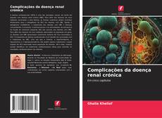 Buchcover von Complicações da doença renal crónica