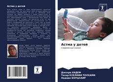 Buchcover von Астма у детей