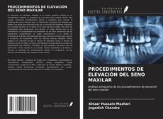 Buchcover von PROCEDIMIENTOS DE ELEVACIÓN DEL SENO MAXILAR
