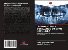 LES PROCÉDURES D'ÉLÉVATION DU SINUS MAXILLAIRE的封面
