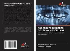 Bookcover of PROCEDURE DI RIALZO DEL SENO MASCELLARE