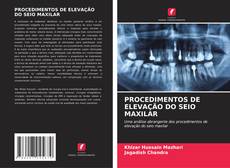 PROCEDIMENTOS DE ELEVAÇÃO DO SEIO MAXILAR kitap kapağı