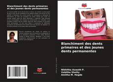 Bookcover of Blanchiment des dents primaires et des jeunes dents permanentes