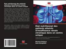 Bookcover of État nutritionnel des patients atteints d'insuffisance rénale chronique dans un centre unique
