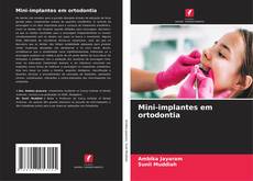 Capa do livro de Mini-implantes em ortodontia 