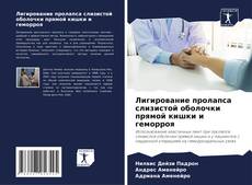 Bookcover of Лигирование пролапса слизистой оболочки прямой кишки и геморроя