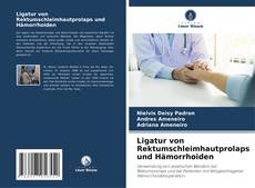 Portada del libro de Ligatur von Rektumschleimhautprolaps und Hämorrhoiden