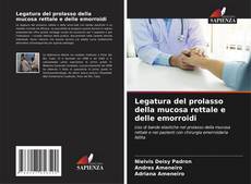 Bookcover of Legatura del prolasso della mucosa rettale e delle emorroidi
