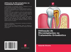 Copertina di Utilização de Microimplantes no Tratamento Ortodôntico