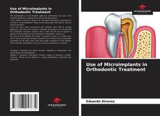 Bookcover of Use of Microimplants in Orthodontic Treatment