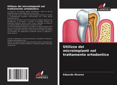 Capa do livro de Utilizzo dei microimpianti nel trattamento ortodontico 