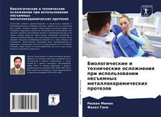 Buchcover von Биологические и технические осложнения при использовании несъемных металлокерамических протезов