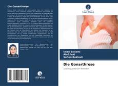 Bookcover of Die Gonarthrose