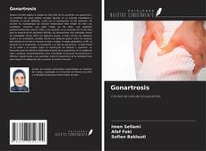 Bookcover of Gonartrosis