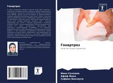 Bookcover of Гонартроз