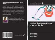 Buchcover von Medios de diagnóstico de la caries dental