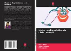 Обложка Meios de diagnóstico da cárie dentária