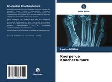 Обложка Knorpelige Knochentumore