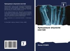 Capa do livro de Хрящевые опухоли костей 