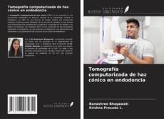 Bookcover of Tomografía computarizada de haz cónico en endodoncia