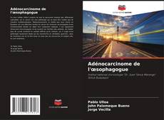 Bookcover of Adénocarcinome de l'œsophagogue