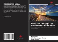 Capa do livro de Adenocarcinoma of the esophagogastric junction 