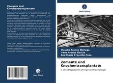 Capa do livro de Zemente und Knochentransplantate 