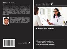 Copertina di Cáncer de mama