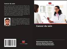 Bookcover of Cancer du sein