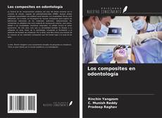 Bookcover of Los composites en odontología