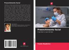Bookcover of Preenchimento facial