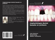 Implantología dental basada en prótesis kitap kapağı
