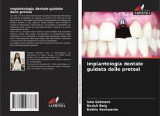 Implantologia dentale guidata dalle protesi kitap kapağı