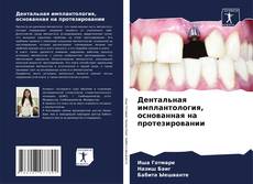 Bookcover of Дентальная имплантология, основанная на протезировании