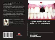 Portada del libro de Implantologie dentaire axée sur les prothèses