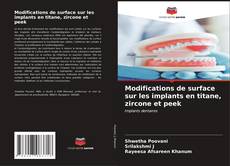 Buchcover von Modifications de surface sur les implants en titane, zircone et peek