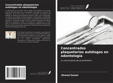 Bookcover of Concentrados plaquetarios autólogos en odontología
