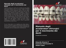 Manuale degli acceleratori chirurgici per il movimento dei denti kitap kapağı