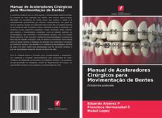 Couverture de Manual de Aceleradores Cirúrgicos para Movimentação de Dentes