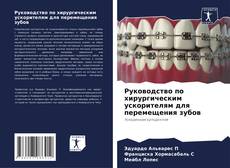 Copertina di Руководство по хирургическим ускорителям для перемещения зубов