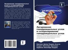 Buchcover von Лигирование геморроидальных узлов и склерозирование геморроидальных узлов