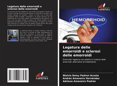 Buchcover von Legatura delle emorroidi e sclerosi delle emorroidi