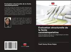 Buchcover von Évaluation structurelle de la fente nasolabiopalatine