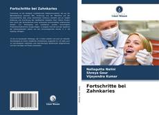 Buchcover von Fortschritte bei Zahnkaries