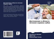 Buchcover von Достижения в области лечения кариеса зубов